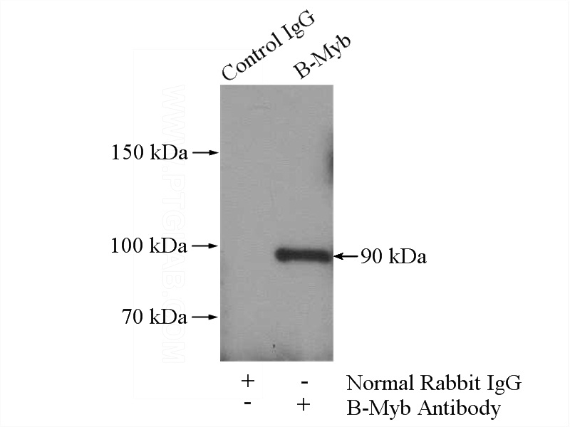IP Result of anti-MYBL2 (IP:Catalog No:117206, 4ug; Detection:Catalog No:117206 1:300) with HeLa cells lysate 1520ug.