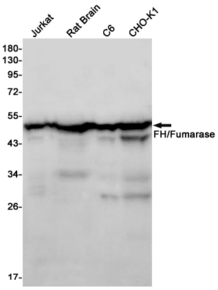 Western blot detection of FH/Fumarase in Jurkat,Rat Brain,C6,CHO-K1 cell lysates using FH/Fumarase Rabbit mAb(1:1000 diluted).Predicted band size:55kDa.Observed band size:49kDa.