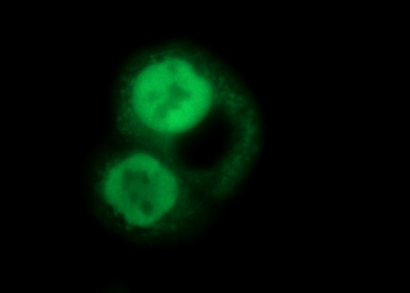 Immunofluorescent analysis of COLO 320 cells using Catalog No:113334(OGFR Antibody) at dilution of 1:50 and Alexa Fluor 488-congugated AffiniPure Goat Anti-Rabbit IgG(H+L)