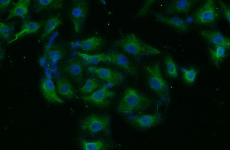 Immunofluorescent analysis of SH-SY5Y cells using Catalog No:115596(SRPK1 Antibody) at dilution of 1:25 and Alexa Fluor 488-congugated AffiniPure Goat Anti-Rabbit IgG(H+L)