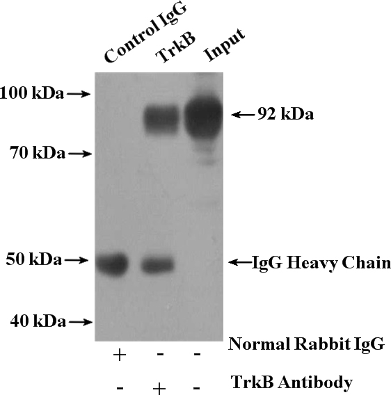 IP Result of anti-NTRK2 (IP:Catalog No:116393, 4ug; Detection:Catalog No:116393 1:300) with mouse cerebellum tissue lysate 4000ug.