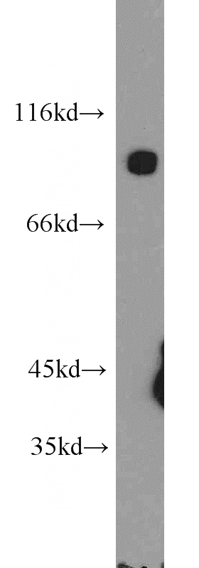 mouse brain tissue were subjected to SDS PAGE followed by western blot with Catalog No:109964(DNM3 antibody) at dilution of 1:800
