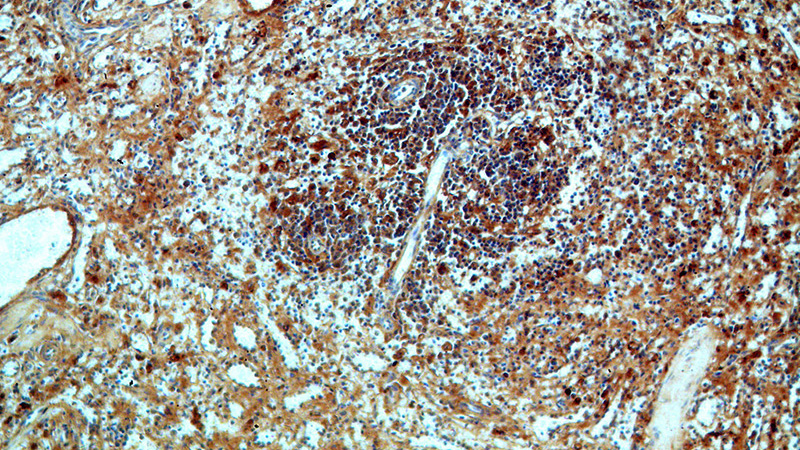 Immunohistochemical of paraffin-embedded human spleen using Catalog No:115212(APCS antibody) at dilution of 1:50 (under 10x lens)