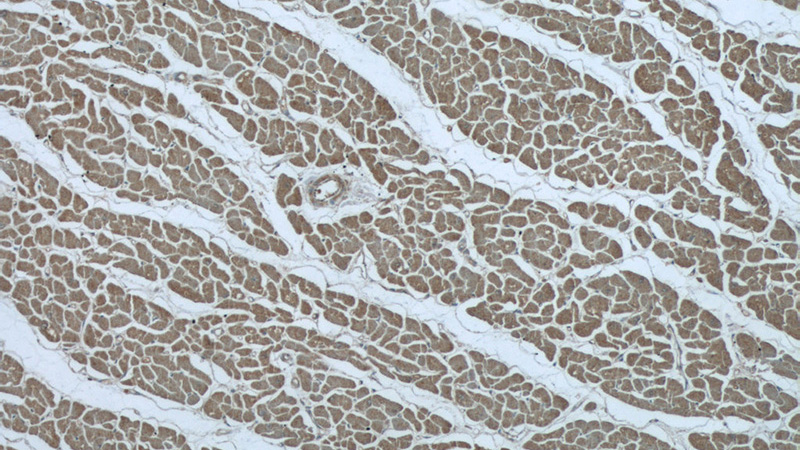 Immunohistochemistry of paraffin-embedded human heart tissue slide using Catalog No:116624(UPB1 Antibody) at dilution of 1:50 (under 10x lens)