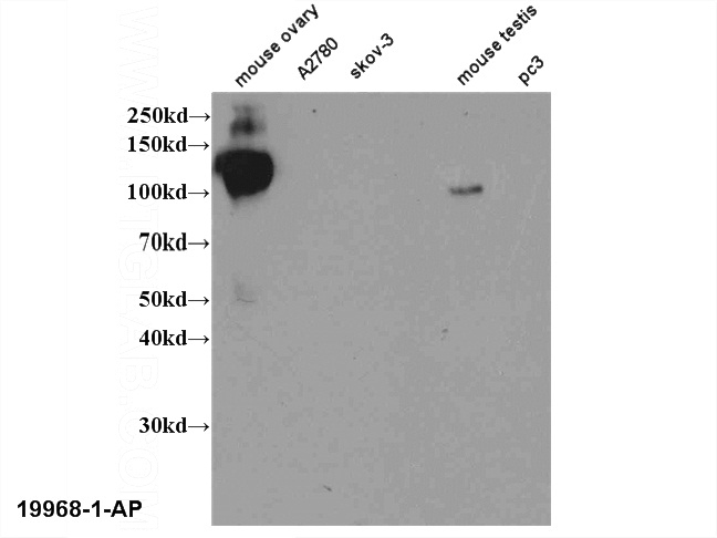 WB result of Catalog No:112214(LHCGR antibody).