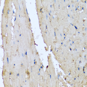 Immunohistochemistry - DEFA1 Polyclonal Antibody 