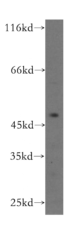 PC-3 cells were subjected to SDS PAGE followed by western blot with Catalog No:109255(CENPL antibody) at dilution of 1:300