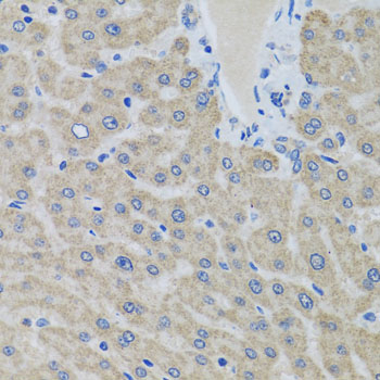 Immunohistochemistry - EIF2S3 Polyclonal Antibody 