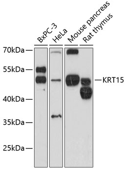 Western blot - KRT15 Polyclonal Antibody 