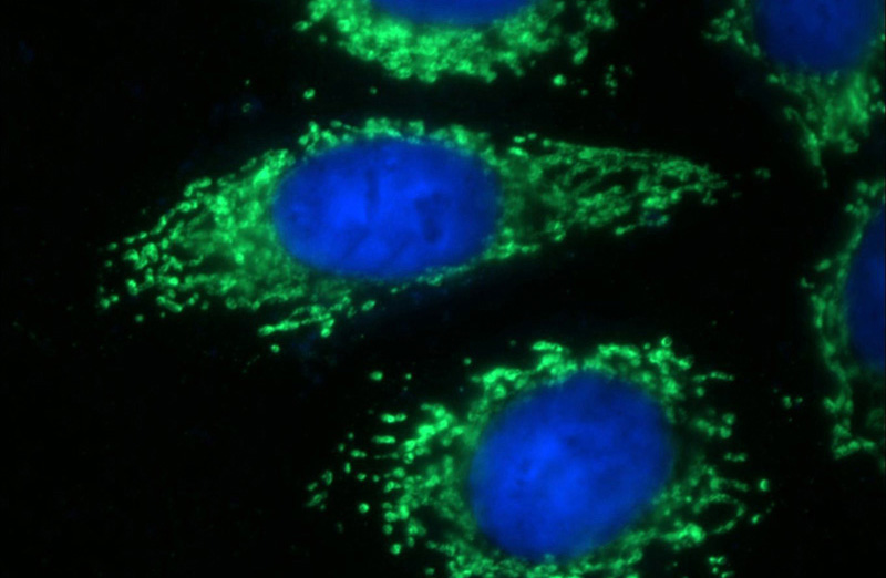 Immunofluorescent analysis of HeLa cells using Catalog No:108011(PRKAG2 Antibody) at dilution of 1:50 and Alexa Fluor 488-congugated AffiniPure Goat Anti-Rabbit IgG(H+L)