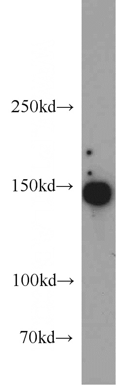 mouse brain tissue were subjected to SDS PAGE followed by western blot with Catalog No:116202(TMF1 antibody) at dilution of 1:3000
