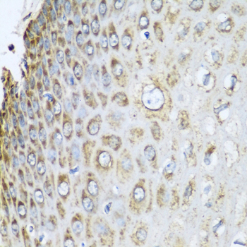 Immunohistochemistry - PHB2 Polyclonal Antibody 