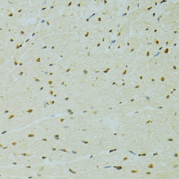 Immunohistochemistry - RCC1 Polyclonal Antibody 