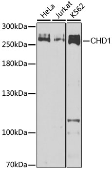 Western blot - CHD1 Polyclonal Antibody 