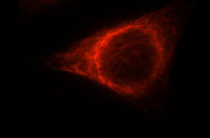 Immunofluorescent analysis of HepG2 cells, using VIM antibody Catalog No:116753 at 1:25 dilution and Rhodamine-labeled goat anti-rabbit IgG (red).