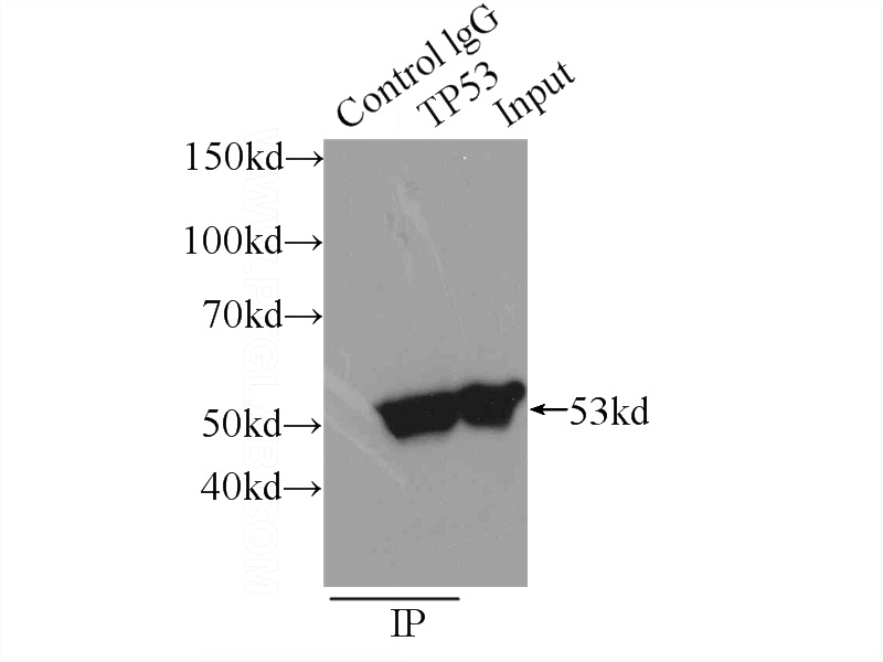 IP Result of anti-TP53 (IP:Catalog No:116258, 3ug; Detection:Catalog No:116258 1:1000) with A431 cells lysate 1650ug.