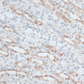 Immunohistochemistry - ZNF415 Polyclonal Antibody 