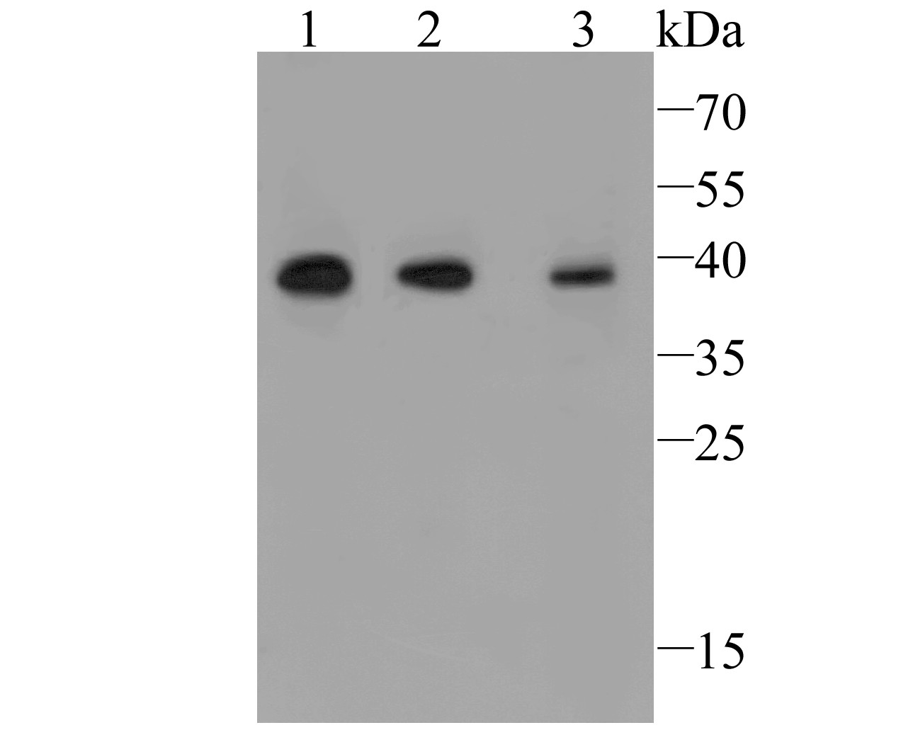 Fig1:; Western blot analysis of TMEM163 on different lysate. Proteins were transferred to a PVDF membrane and blocked with 5% BSA in PBS for 1 hour at room temperature. The primary antibody ( 1/1000) was used in 5% BSA at room temperature for 2 hours. Goat Anti-Rabbit IgG - HRP Secondary Antibody (HA1001) at 1:5,000 dilution was used for 1 hour at room temperature.; Positive control:; Lane 1: Human skin tissue lysate; Lane 2: Human small intestine tissue lysate; Lane 3: Human mouse colon tissue lysate; Predicted band size: 31 kDa; Observed band size: 38 kDa