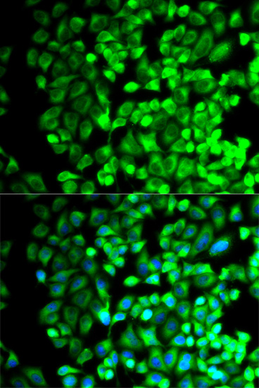 Immunofluorescence - TBXAS1 Polyclonal Antibody 