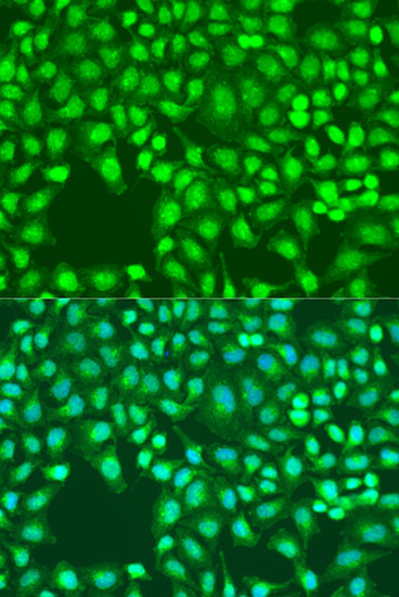 Immunofluorescence - Defb26 Polyclonal Antibody 
