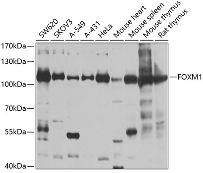 Western blot - FOXM1 Polyclonal Antibody 