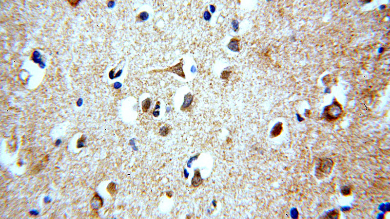 Immunohistochemical of paraffin-embedded human brain using Catalog No:115588(SRGAP3-Specific antibody) at dilution of 1:100 (under 40x lens)