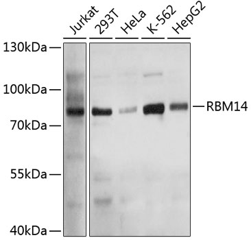Western blot - RBM14 Polyclonal Antibody 