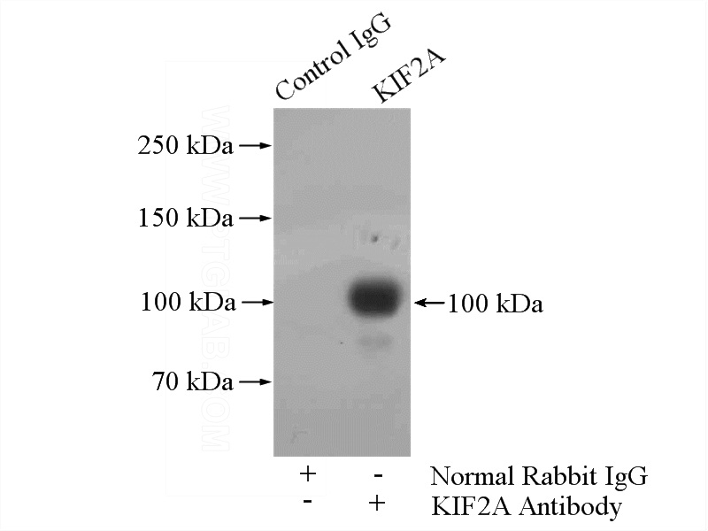 IP Result of anti-KIF2A (IP:Catalog No:112010, 4ug; Detection:Catalog No:112010 1:1000) with mouse brain tissue lysate 4000ug.