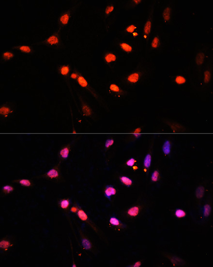 Immunofluorescence - Kdm6b Polyclonal Antibody 