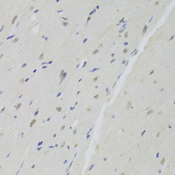 Immunohistochemistry - DOK1 Polyclonal Antibody 