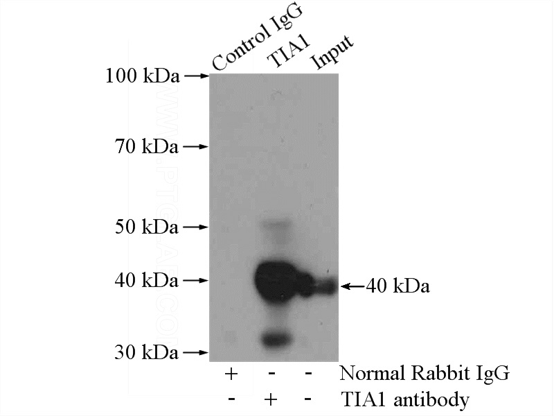 IP Result of anti-TIA1 (IP:Catalog No:116118, 4ug; Detection:Catalog No:116118 1:500) with Jurkat cells lysate 3200ug.