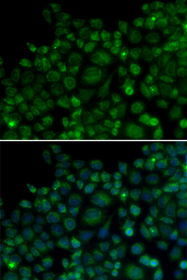 Immunofluorescence - TLR7 Polyclonal Antibody 