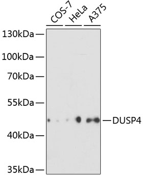 Western blot - DUSP4 Polyclonal Antibody 