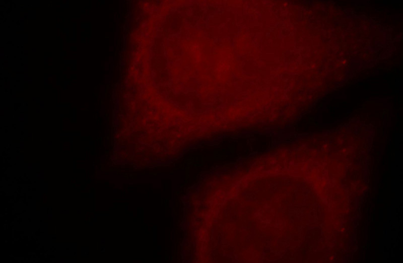Immunofluorescent analysis of HepG2 cells, using NLRP3 antibody Catalog No:113019 at 1:25 dilution and Rhodamine-labeled goat anti-rabbit IgG (red).