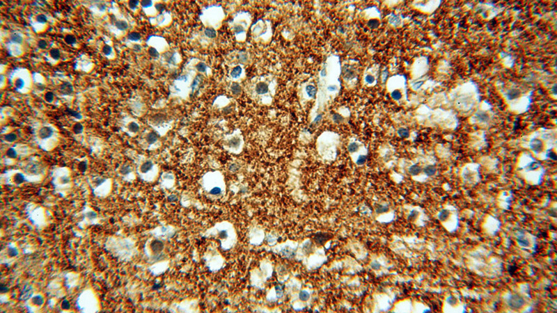 Immunohistochemical of paraffin-embedded human brain using Catalog No:107879(SNCA antibody) at dilution of 1:50 (under 40x lens)