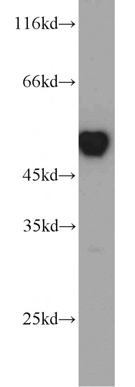 HEK-293 cells were subjected to SDS PAGE followed by western blot with Catalog No:114939(RUVBL1 antibody) at dilution of 1:1000