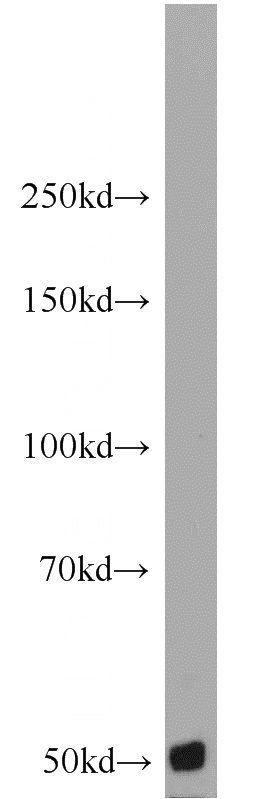 PC-3 cells were subjected to SDS PAGE followed by western blot with Catalog No:108858(CARD9 antibody) at dilution of 1:500