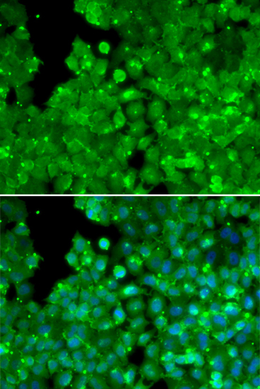 Immunofluorescence - IL10RA Polyclonal Antibody 