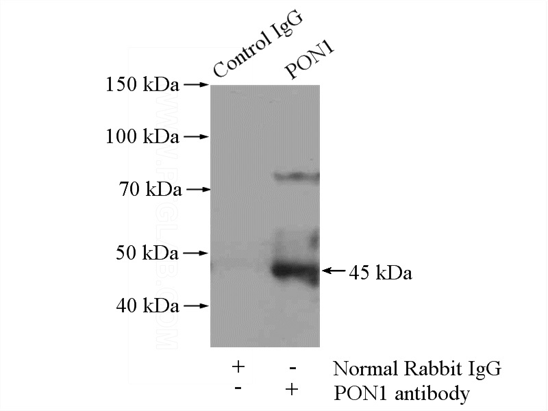 IP Result of anti-PON1 (IP:Catalog No:114058, 4ug; Detection:Catalog No:114058 1:500) with mouse liver tissue lysate 4000ug.