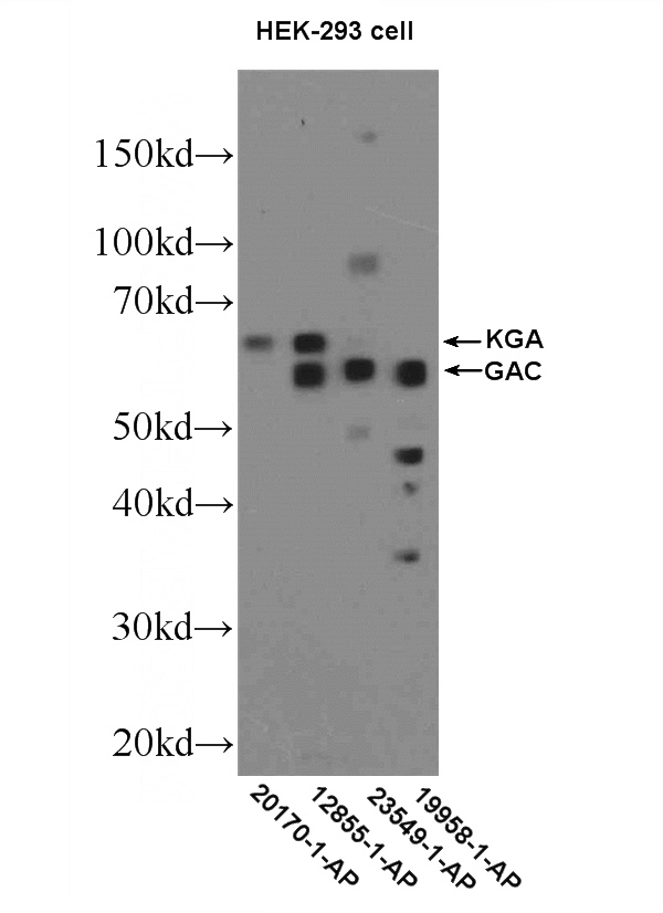 HEK-293 cells were subjected to SDS PAGE followed by western blot with Catalog No:112033(GLS Antibody) at dilution of 1:600