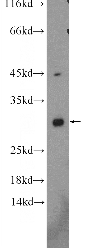 human testis tissue were subjected to SDS PAGE followed by western blot with Catalog No:108084(ANKRD7 Antibody) at dilution of 1:300