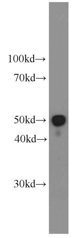 human testis tissue were subjected to SDS PAGE followed by western blot with Catalog No:107066(APOH antibody) at dilution of 1:1000