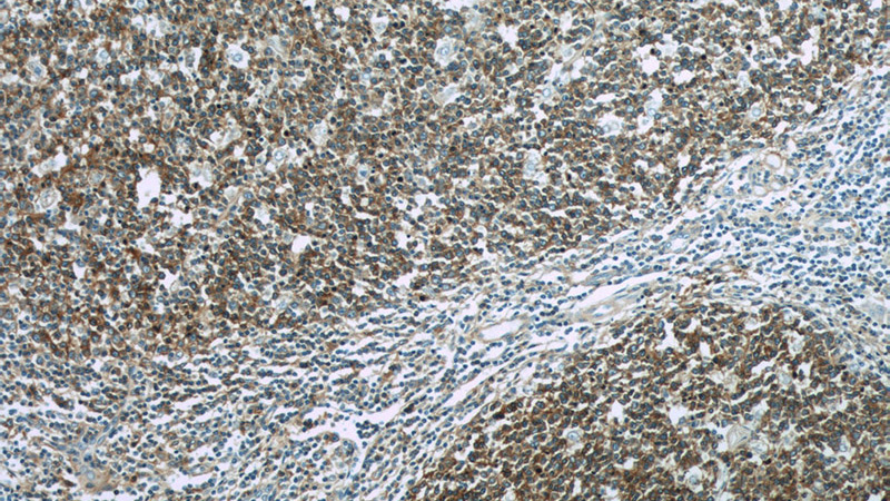 Immunohistochemistry of paraffin-embedded human tonsillitis slide using Catalog No:114631(RFTN1 Antibody) at dilution of 1:50 (under 10x lens)