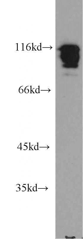 A549 cells were subjected to SDS PAGE followed by western blot with Catalog No:111514(HNRNPUL1 antibody) at dilution of 1:2000