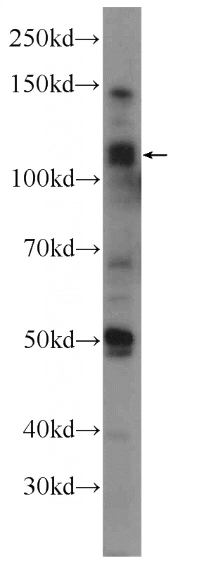 mouse testis tissue were subjected to SDS PAGE followed by western blot with Catalog No:115929(TDRD5 Antibody) at dilution of 1:300