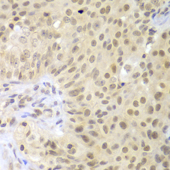 Immunohistochemistry - LHX4 Polyclonal Antibody 