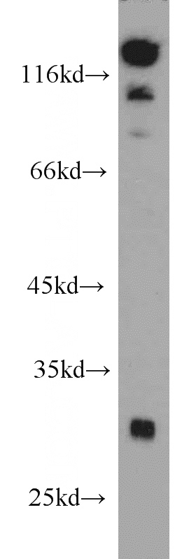 mouse brain tissue were subjected to SDS PAGE followed by western blot with Catalog No:115572(SPIN2B antibody) at dilution of 1:500