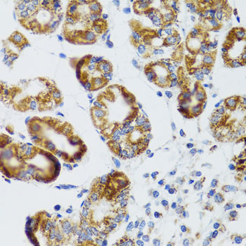 Immunohistochemistry - RIPK4 Polyclonal Antibody 