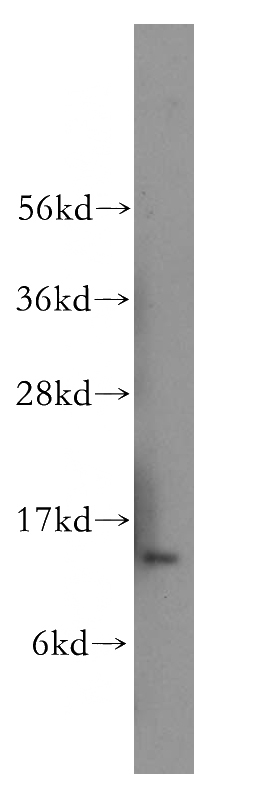 human heart tissue were subjected to SDS PAGE followed by western blot with Catalog No:113766(PDCD5 antibody) at dilution of 1:500