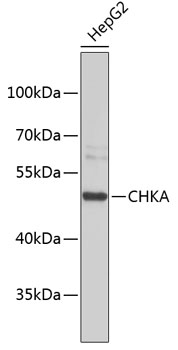 Western blot - CHKA Polyclonal Antibody 